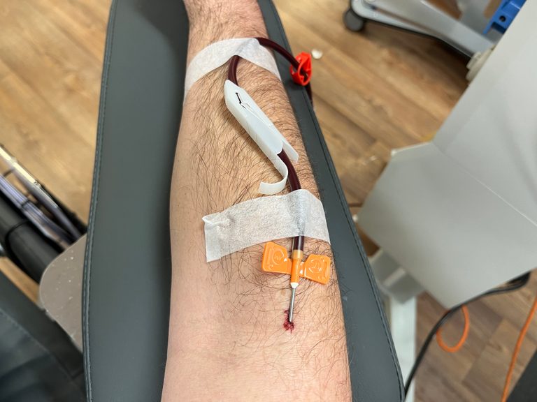 My right arm rigged up for donating plasma with the needle in my elbow and the tube taped to my lower arm